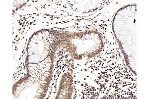 Immunohistochemistry analysis of paraffin-embedded human colon using LEP Polyclonal Antibody at dilution of 1:100. (Leptin antibody)