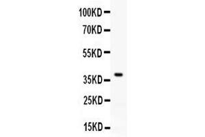 Western blot analysis of RANKL expression in rat brain extract ( Lane 1).