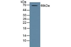Detection of ADAM10 in Human Placenta Tissue using Polyclonal Antibody to A Disintegrin And Metalloprotease 10 (ADAM10) (ADAM10 antibody  (AA 420-641))