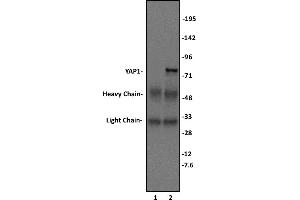 YAP1 antibody (pAb) tested by Immunoprecipitation. (YAP1 antibody  (C-Term))