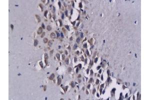 Formalin-fixed and paraffin embedded mouse brain tissue labeled with Anti-CCL17/ABCD2 Polyclonal Antibody, Unconjugated  followed by conjugation to the secondary antibody (CCL17 antibody  (AA 41-103))