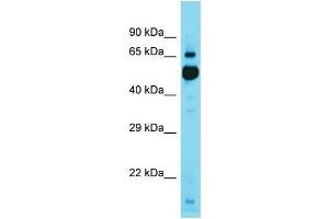 Western Blotting (WB) image for anti-Kelch Repeat and BTB (POZ) Domain Containing 11 (KBTBD11) (C-Term) antibody (ABIN2791602) (KBTBD11 antibody  (C-Term))