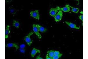 Detection of LEI in Human Hela Cell using Polyclonal Antibody to Leukocyte Elastase Inhibitor (LEI) (SERPINB1 antibody  (AA 184-368))