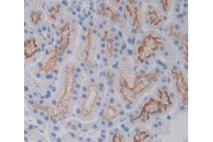 Detection of VEGFR2 in Rat Kidney Tissue using Polyclonal Antibody to Vascular Endothelial Growth Factor Receptor 2 (VEGFR2) (VEGFR2/CD309 antibody  (AA 46-320))