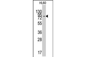 Western blot analysis of SLC16A1 polyclonal antibody  in HL-60 cell line lysates (35 ug/lane). (SLC16A1 antibody  (C-Term))