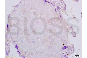 Formalin-fixed and paraffin embedded human placenta labeled with Anti-FBN1/fibrillin 1 Polyclonal Antibody, Unconjugated (ABIN738501) at 1:200 followed by conjugation to the secondary antibody and DAB staining. (Fibrillin 1 antibody  (AA 401-500))