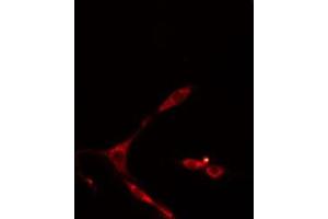 ABIN6274958 staining HepG2 cells by IF/ICC. (CA13 antibody  (Internal Region))