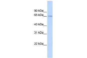 SLC22A6 antibody used at 1 ug/ml to detect target protein.