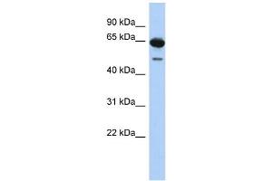 WB Suggested Anti-DAZ1 Antibody Titration: 0. (DAZ1 antibody  (N-Term))