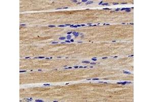 Immunohistochemistry analysis of paraffin-embedded rat muscle using,CTNT (ABIN7076033) at dilution of 1: 400 (Cardiac Troponin T2 antibody)