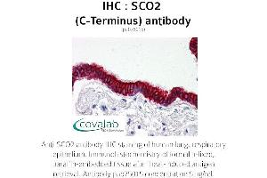 Image no. 2 for anti-SCO2 Cytochrome C Oxidase Assembly Protein (SCO2) antibody (ABIN1739069)