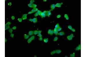 Immunofluorescence staining of SH-SY5Y cells with ABIN7160817 at 1:133, counter-stained with DAPI. (NLRP1 antibody  (AA 1-146))