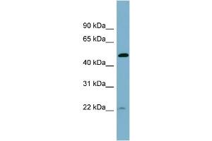 WB Suggested Anti-UCHL5IP  Antibody Titration: 0. (HAUS7 antibody  (Middle Region))