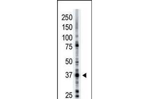 Antibody is used in Western blot to detect ART1 in mouse brain tissue lysate. (ART1 antibody  (N-Term))