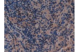 Immunohistochemistry (IHC) image for anti-beta-2-Microglobulin (B2M) (AA 22-119) antibody (ABIN7427840)