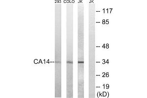 Western Blotting (WB) image for anti-Carbonic Anhydrase XIV (CA14) (Internal Region) antibody (ABIN1851004) (CA14 antibody  (Internal Region))