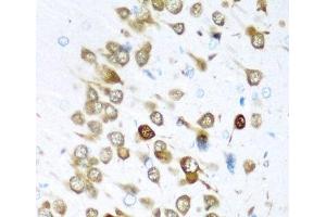 Immunohistochemistry of paraffin-embedded Rat brain using ELAVL3 Polyclonal Antibody at dilution of 1:200 (40x lens). (HuC/ELAVL3 antibody)