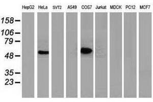 Image no. 3 for anti-Tumor Protein P53 (TP53) antibody (ABIN1499967) (p53 antibody)
