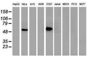 Image no. 3 for anti-Tumor Protein P53 (TP53) antibody (ABIN1499967)