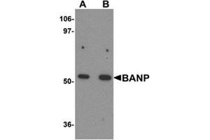 Western blot analysis of BANP in mouse kidney tissue lysate with BANP antibody at (A) 1 and (B) 2 μg/ml. (BANP antibody  (Center))