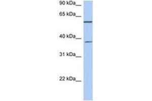 Image no. 1 for anti-Nucleoporin 43kDa (NUP43) (C-Term) antibody (ABIN6743925) (NUP43 antibody  (C-Term))