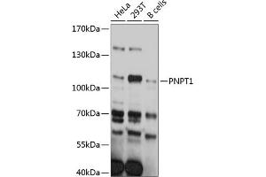 Western blot analysis of extracts of various cell lines, using PNPT1 antibody (ABIN6129746, ABIN6145862, ABIN6145863 and ABIN6215368) at 1:3000 dilution. (PNPT1 antibody  (AA 1-260))