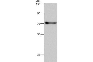Western Blot analysis of Mouse brain tissue using PATZ1 Polyclonal Antibody at dilution of 1:250 (PATZ1 antibody)