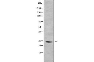 Western blot analysis of EIF4E3 using COLO205 whole cell lysates