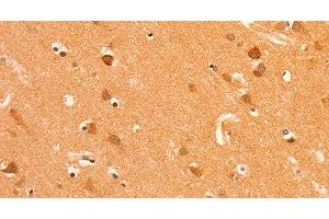 Immunohistochemistry of paraffin-embedded Human brain tissue using GRM3 Polyclonal Antibody at dilution 1:50 (Metabotropic Glutamate Receptor 3 antibody)