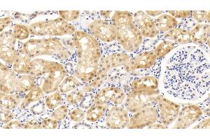 Detection of SOD1 in Bovine Kidney Tissue using Monoclonal Antibody to Superoxide Dismutase 1 (SOD1) (SOD1 antibody  (AA 2-152))