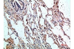 Immunohistochemical analysis of paraffin-embedded human-lung, antibody was diluted at 1:200