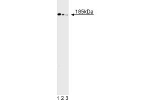 Western Blotting (WB) image for anti-Deleted in Colorectal Carcinoma (DCC) antibody (ABIN967443) (DCC antibody)