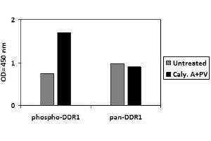 DDR1 ELISA Kit