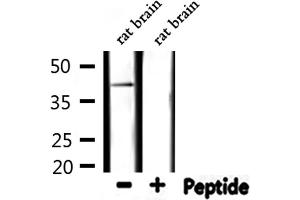 EPHX4 antibody  (Internal Region)