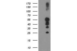 HEK293T cells were transfected with the pCMV6-ENTRY control (Left lane) or pCMV6-ENTRY PTPN1 (Right lane) cDNA for 48 hrs and lysed. (PTPN1 antibody)
