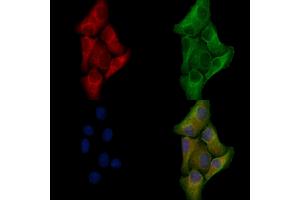 ABIN6257222 and ABIN6276028 staining Hela cells by IF/ICC.