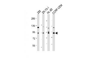 All lanes : Anti-P9 Antibody at 1:500-1:2000 dilution Lane 1: 293 whole cell lysate Lane 2: ZR-75-1 whole cell lysate Lane 3: HL-60 whole cell lysate Lane 4: CCRF-CEM whole cell lysate Lysates/proteins at 20 μg per lane. (MMP 9 antibody)