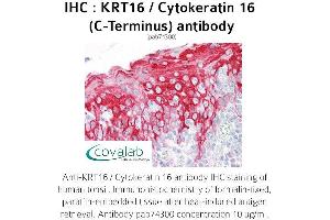 Image no. 1 for anti-Keratin 16 (KRT16) antibody (ABIN1736281) (KRT16 antibody)