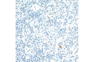 Immunohistochemistry (IHC) image for anti-V-Maf Musculoaponeurotic Fibrosarcoma Oncogene Homolog (Avian) (MAF) (AA 125-175) antibody (ABIN7455089) (Recombinant MAF antibody  (AA 125-175))