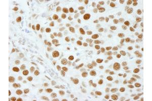 Immunohistochemistry (IHC) image for anti-5'-3' Exoribonuclease 2 (XRN2) (AA 900-950) antibody (ABIN7449038)