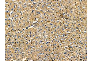 ABIN7095553 and ABIN7099610 at 1/100 staining mouse liver tissue by IHC-P. (IREB2 antibody)