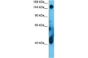 Host:  Rabbit  Target Name:  COIA1  Sample Type:  MCF7 Whole Cell  Antibody Dilution:  1. (COL18A1 antibody  (Middle Region))