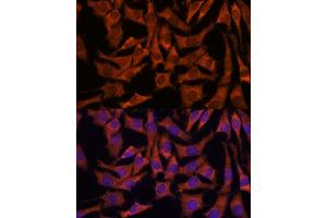 Immunofluorescence analysis of L929 cells using Sec23B antibody (ABIN7270169) at dilution of 1:100. (Sec23 Homolog B antibody  (AA 150-250))