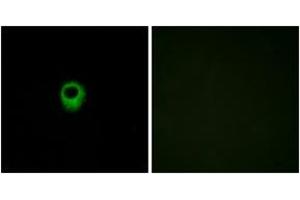 Immunofluorescence analysis of MCF7 cells, using EDG4 Antibody. (EDG4 antibody  (AA 271-320))