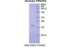 SDS-PAGE analysis of Human Peroxiredoxin 2 Protein.