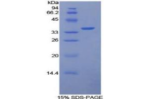 SDS-PAGE analysis of Rabbit Tissue Factor Protein.