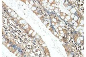 Immunohistochemical staining of formalin-fixed paraffin-embedded human fetal small intestine tissue showing cytoplasmic staining with RICTOR polyclonal antibody  at 1 : 100 dilution. (RICTOR antibody  (AA 1406-1700))