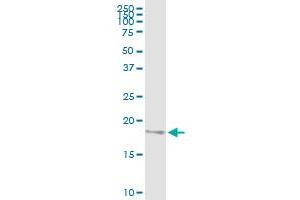 Immunoprecipitation (IP) image for anti-NADH Dehydrogenase (Ubiquinone) 1 beta Subcomplex, 6, 17kDa (NDUFB6) (AA 1-128) antibody (ABIN518238)