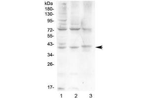 Western blot testing of human 1) HeLa, 2) HepG2 and 3) A431 cell lysate with HFE antibody at 0. (HFE antibody)