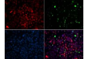 Immunofluorescence analysis of GFP-RNF168 transgenic U2OS cells using CETN2 antibody.